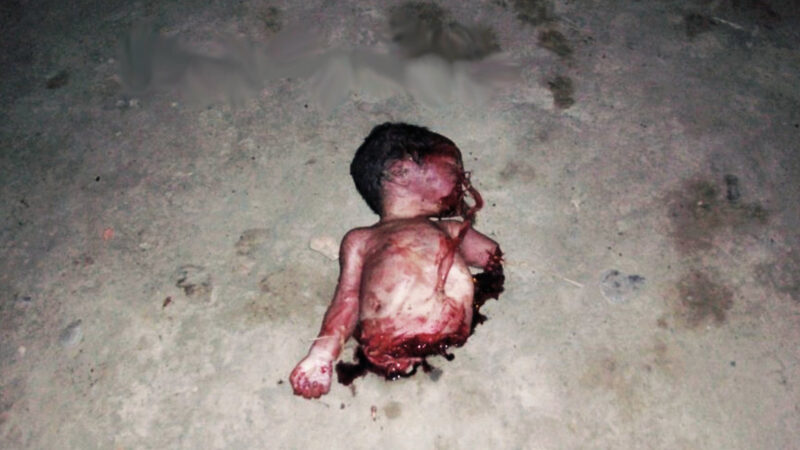 Planned Parenthood. Aborto. Bebé descuartizado.