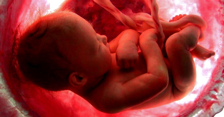 El aborto fue la principal causa mundial de muerte en 2024 con más de 45 millones de muertos (alertadigital.com).